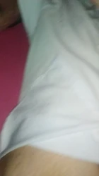 露脸，看看这个应该叫什么逼，毛太多了，怎么才能去毛。请指教。谢谢