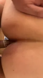 肛交有痔疮的超级大屁股