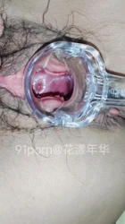 淫妻开发之透明扩阴器看子宫口