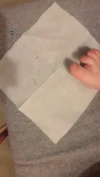 喂脚趾甲 死皮