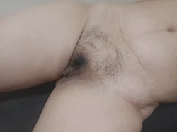 曝光奶子有胎记的剖腹产少妇