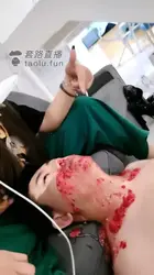 双女王呕吐