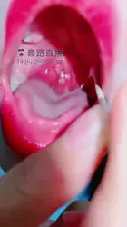 口腔检查